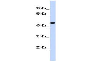 Human Heart; WB Suggested Anti-ACOT2 Antibody Titration: 0. (ACOT2 antibody  (Middle Region))