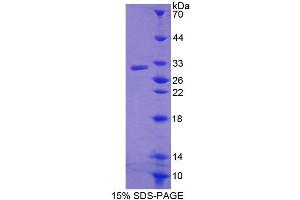 SDS-PAGE (SDS) image for ATP-Binding Cassette, Sub-Family C (CFTR/MRP), Member 11 (ABCC11) (AA 1141-1382) protein (His tag) (ABIN4989904) (ABCC11 Protein (AA 1141-1382) (His tag))