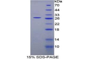 SDS-PAGE (SDS) image for Natural Killer Cell Receptor 2B4 (CD244) (AA 20-221) protein (His tag) (ABIN1879562)