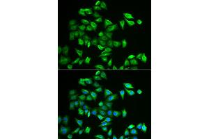 Immunofluorescence analysis of A549 cells using POMGNT2 antibody (ABIN2562968). (C3orf39 antibody)