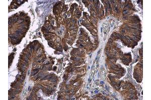 Immunohistochemistry (IHC) image for anti-Signal Transducer and Activator of Transcription 2, 113kDa (STAT2) (C-Term) antibody (ABIN2855558)