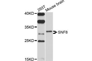 Western blot analysis of extracts of various cell lines, using SNF8 antibody (ABIN4905253) at 1:1000 dilution.