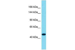 Host:  Rabbit  Target Name:  SLC39A10  Sample Type:  Thyroid Tumor lysates  Antibody Dilution:  1. (SLC39A10 antibody  (N-Term))