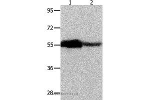 Western blot analysis of Human ovarian cancer and mouse heart tissue, using CBX2 Polyclonal Antibody at dilution of 1:350