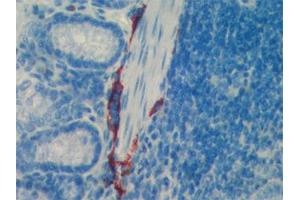 Immunohistochemistry detection of endogenous LYVE-1 in paraffin-embedded sections of mouse intestine using anti-LYVE-1 (mouse), pAb  (red staining of lymphatic endothelial intestine cells). (LYVE1 antibody  (AA 24-228))