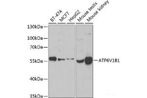 Western blot analysis of extracts of various cell lines using ATP6V1B1 Polyclonal Antibody at dilution of 1:1000. (ATP6V1B1 antibody)