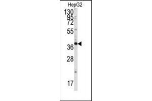 Image no. 1 for anti-SH3-Domain GRB2-Like Endophilin B1 (SH3GLB1) (Tyr80) antibody (ABIN360475) (SH3GLB1 antibody  (Tyr80))