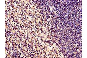 Immunohistochemistry of paraffin-embedded human spleen tissue using ABIN7160145 at dilution of 1:100 (ABHD2 antibody  (AA 31-320))