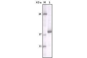 Western blot analysis using DDR2 mouse mAb against truncated DDR2 recombinant protein.
