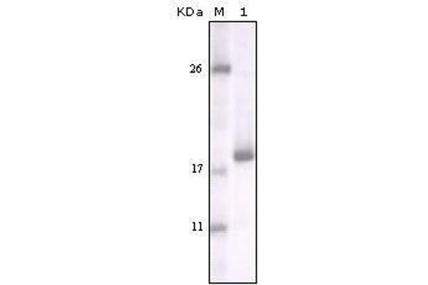 DDR2 Antikörper