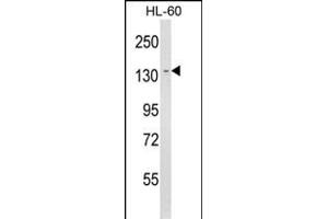 Western blot analysis of LY75 Antibody (Center) (ABIN652943 and ABIN2842602) in HL-60 cell line lysates (35 μg/lane). (LY75/DEC-205 antibody  (AA 646-675))
