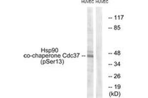 Western blot analysis of extracts from HuvEc cells, using CDC37 (Phospho-Ser13) Antibody. (CDC37 antibody  (pSer13))