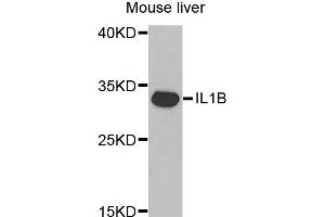 Western blot analysis of extracts of Mouse liver tissue, using IL1B antibody. (IL-1 beta antibody)