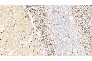 Detection of SEMA5B in Human Cerebellum Tissue using Monoclonal Antibody to Semaphorin 5B (SEMA5B) (SEMA5B antibody  (AA 350-602))