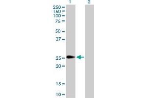 Western Blot analysis of PIP5K1C expression in transfected 293T cell line by PIP5K1C MaxPab polyclonal antibody. (PIP5K1C antibody  (AA 1-206))
