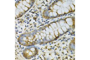 Immunohistochemistry of paraffin-embedded human colon using GSTM2 Antibody. (GSTM2 antibody)