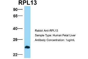 Host:  Rabbit  Target Name:  RPL13  Sample Type:  Human Fetal Liver  Antibody Dilution:  1. (RPL13 antibody  (C-Term))