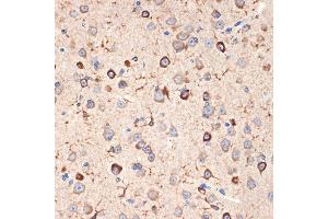 Immunohistochemistry of paraffin-embedded mouse brain using Musashi-2 (Musashi-2 (MSI2)) Rabbit mAb (ABIN7268701) at dilution of 1:100 (40x lens). (MSI2 antibody)