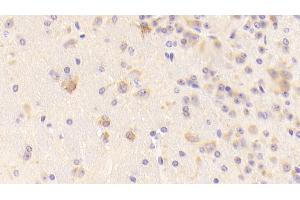 Detection of TFR in Mouse Cerebrum Tissue using Polyclonal Antibody to Transferrin Receptor (TFR) (Transferrin Receptor antibody  (AA 572-757))
