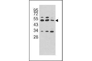 Western blot analysis of C antibody (C-term) (ABIN391510 and ABIN2841472) in Hela, CEM and NCI- cell line lysates (35 μg/lane). (CPA4 antibody  (C-Term))