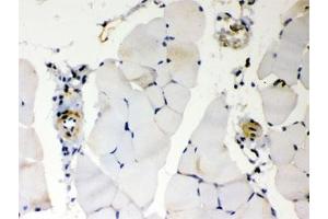 Immunohistochemistry (IHC) image for anti-BCL2-Antagonist/killer 1 (BAK1) (AA 22-211) antibody (ABIN4950296)