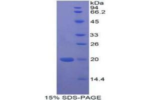 SDS-PAGE analysis of Human MFAP5 Protein.