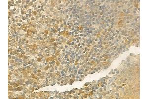 ABIN6257284 and ABIN6274172 at 1/100 staining human normal tonsil tissue by IHC-P. (IRF2 antibody  (Internal Region))