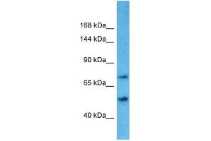 Host: Rabbit Target Name: TBC1D8B Sample Type: Placenta lysates Antibody Dilution: 1.