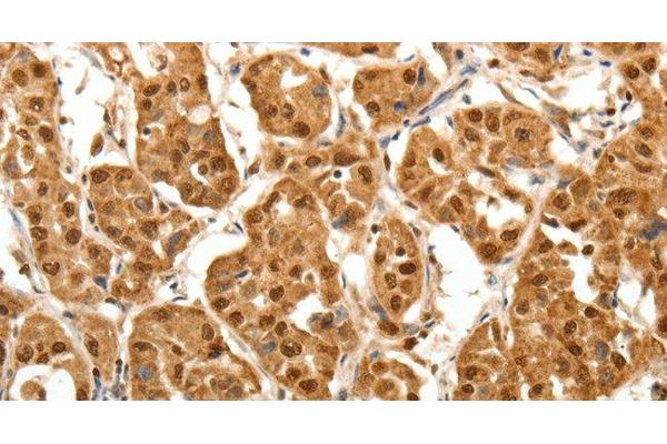 Tenascin N antibody