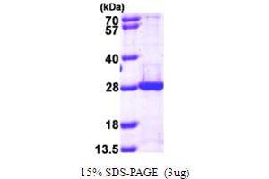 SDS-PAGE (SDS) image for Proteasome (Prosome, Macropain) Subunit, beta Type, 5 (PSMB5) (AA 60-263) protein (His tag) (ABIN667858)