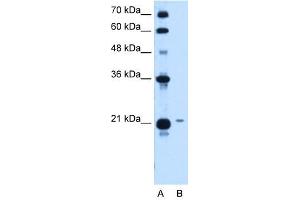 TCP10L antibody used at 1. (TCP10L antibody)