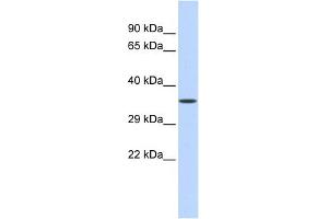 WB Suggested Anti-ZNF124 Antibody Titration:  0.