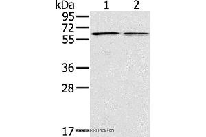 Western blot analysis of Mouse liver and lung tissue, using PTGER2 Polyclonal Antibody at dilution of 1:200 (PTGER2 antibody)