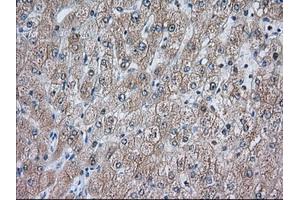 Immunohistochemistry (IHC) image for anti-Acetyl-CoA Acetyltransferase 2 (ACAT2) antibody (ABIN1496400) (ACAT2 antibody)