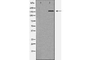 Western blot analysis of Hepg2 whole cell lysates, using SMARCA4 Antibody. (SMARCA4 antibody  (N-Term))