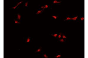 ABIN6269035 staining MCF-7 cells by IF/ICC.