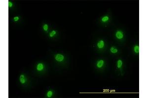 Immunofluorescence of monoclonal antibody to SMAD2 on HeLa cell. (SMAD2 antibody  (AA 181-280))