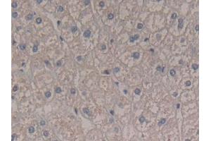 DAB staining on IHC-P; Samples: Human Liver Tissue (Interferon gamma antibody  (AA 24-166))