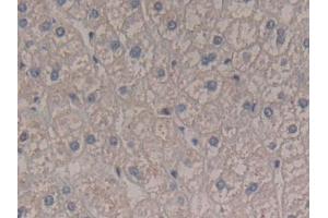 DAB staining on IHC-P; Samples: Human Liver Tissue (Interferon gamma antibody  (AA 24-166))