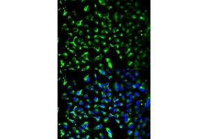 Immunofluorescence analysis of HeLa cells using PHB antibody. (Prohibitin antibody  (AA 73-272))