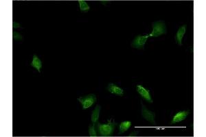 Immunofluorescence of monoclonal antibody to IL1A on HeLa cell.