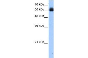 WB Suggested Anti-RELB Antibody Titration:  1. (RELB antibody  (C-Term))