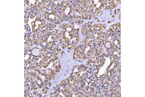 IHC analysis of TOM1L1 using anti-TOM1L1 antibody (ABIN7602631).