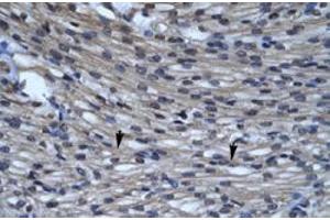 Immunohistochemical staining (Formalin-fixed paraffin-embedded sections) of human heart with CLIC5 polyclonal antibody  at 4-8 ug/mL working concentration. (CLIC5 antibody  (C-Term))