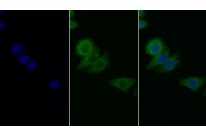 Detection of PAI1 in Human Hela cell using Monoclonal Antibody to Plasminogen Activator Inhibitor 1 (PAI1) (PAI1 antibody)