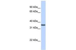 Image no. 1 for anti-COP9 Constitutive Photomorphogenic Homolog Subunit 5 (Arabidopsis) (COPS5) (N-Term) antibody (ABIN6742215) (COPS5 antibody  (N-Term))