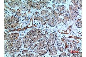 Immunohistochemistry (IHC) analysis of paraffin-embedded Human Pancreas, antibody was diluted at 1:100. (CXCR6 antibody  (N-Term))