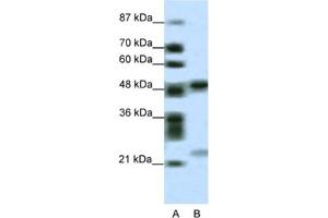 Western Blotting (WB) image for anti-PHD Finger Protein 11 (PHF11) antibody (ABIN2461063) (PHF11 antibody)