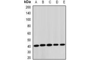 Western blot analysis of STK19 expression in Jurkat (A), HepG2 (B), mouse liver (C), rat lung (D), rat brain (E) whole cell lysates.