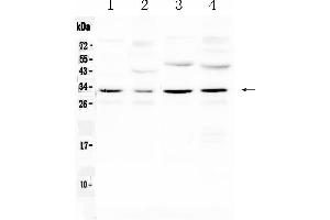Western blot analysis of Aquaporin 3 using anti- Aquaporin 3 antibody . (AQP3 antibody  (Middle Region))